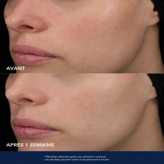 Baume réparateur de la barrière cutanée – IMAGE MD (Image Skincare)