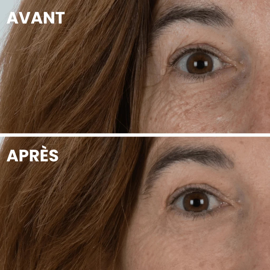 Lifter Masque Apaisant Yeux – K’Derm