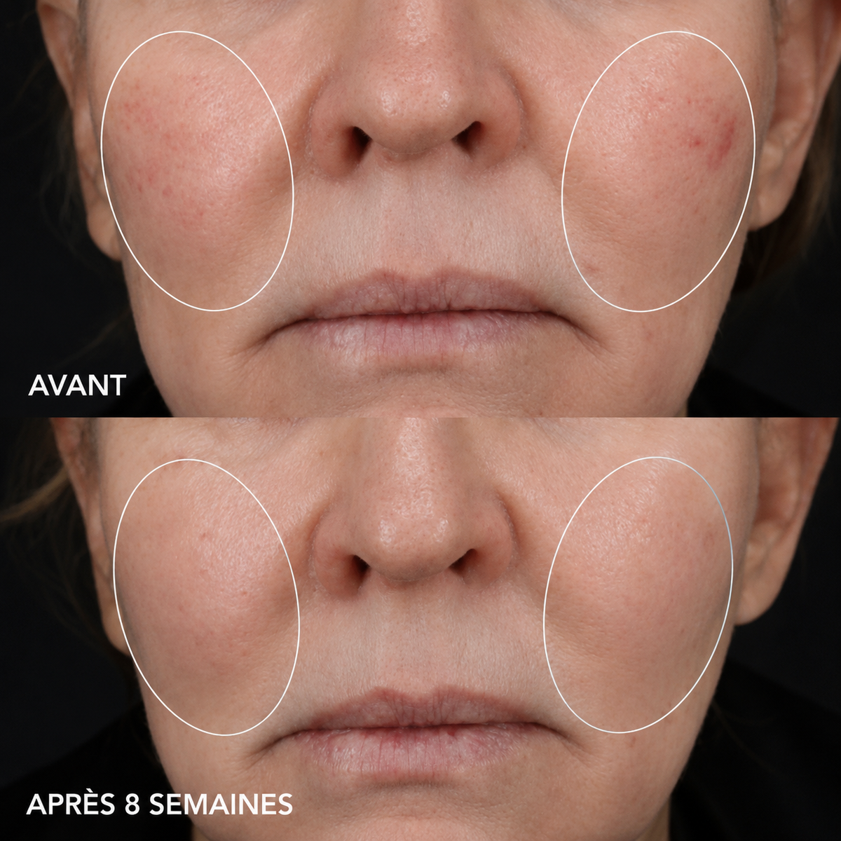 Crème Biotech Longevity – IMAGE MD (Image Skincare)