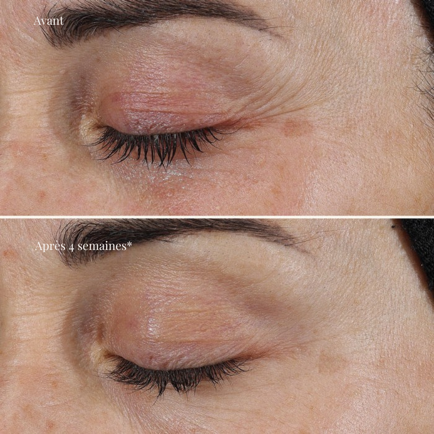 Crème réparatrice au complexe de rétinol 0,3 % – Ageless+ (Image Skincare)