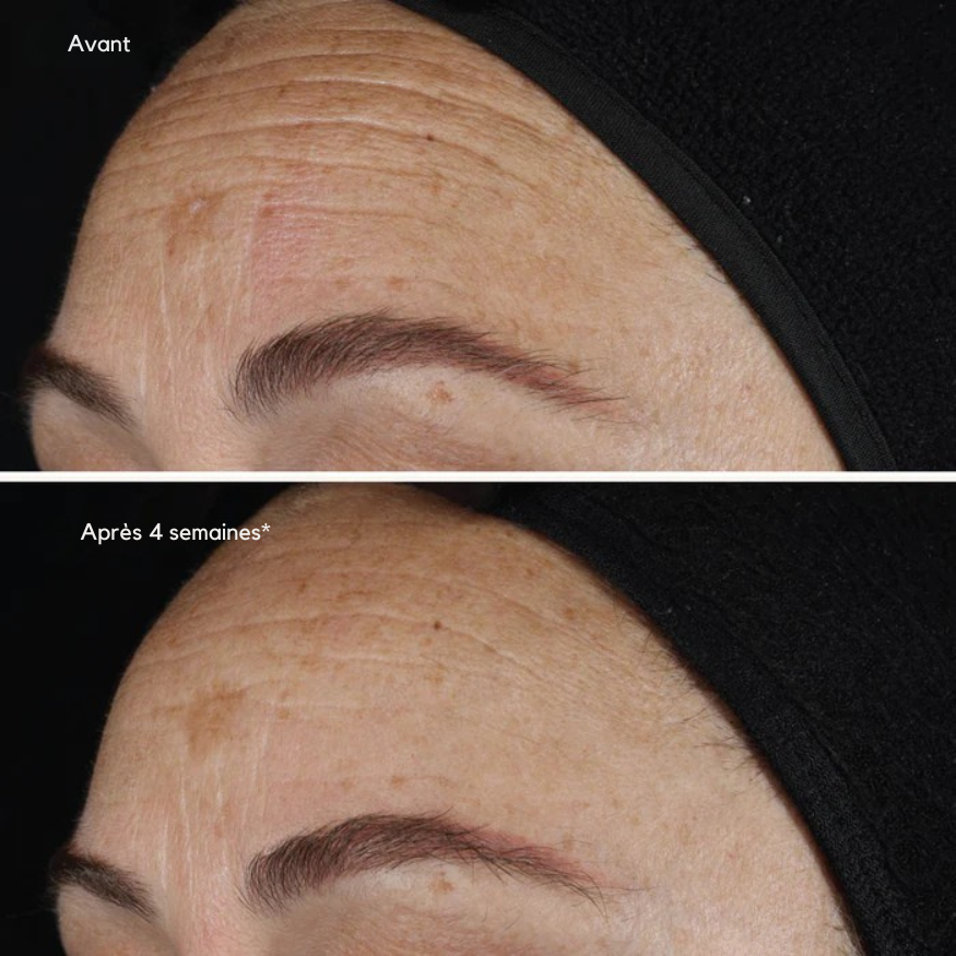 Pur liquide au rétinol 0,1 % – Ageless+ (Image Skincare)