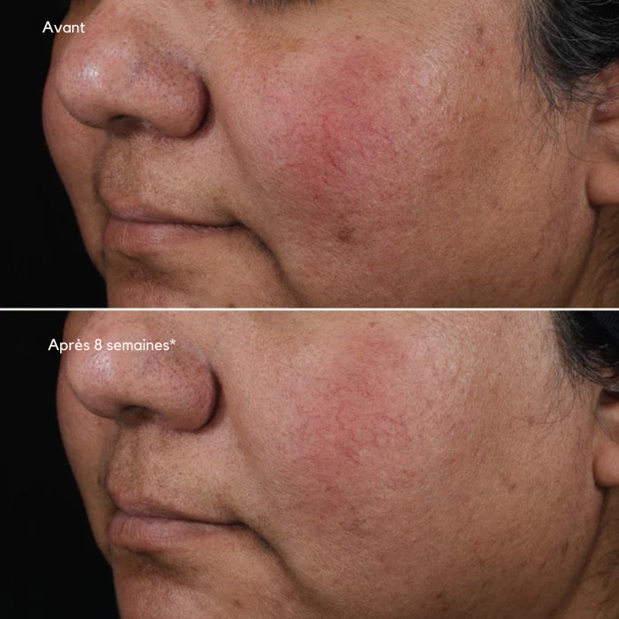 Pur liquide au rétinol 0,75 % – Ageless+ (Image Skincare)